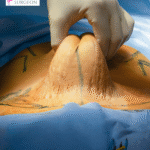 Post-Pregnancy Body Transformation: How Dr. Richie Gupta Helps Women Restore Confidence After Motherhood